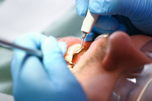 Best Emergency Gum Treatment in Pearl City, HI